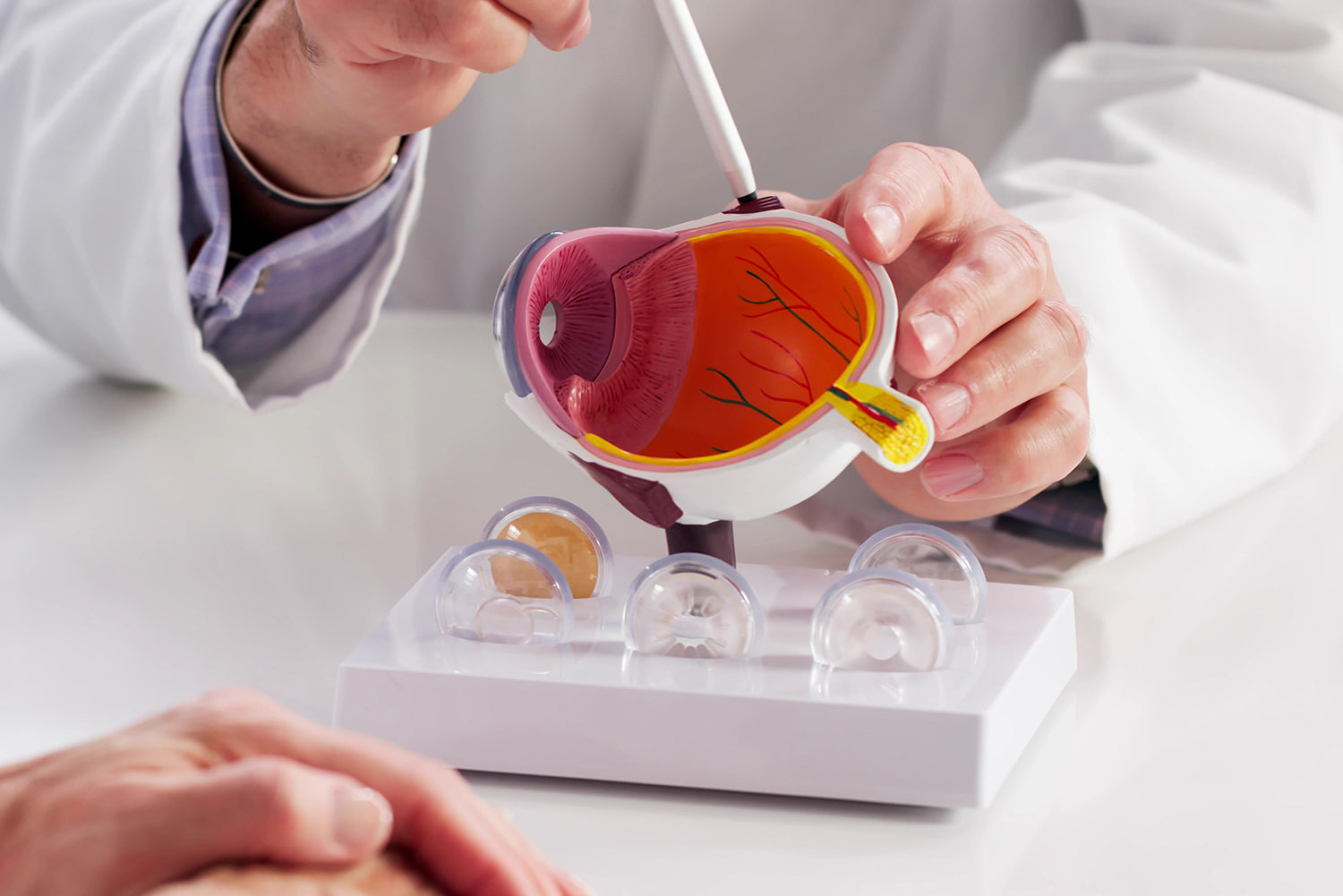 Tension oculaire et hypertension oculaire : comprendre pour mieux agir